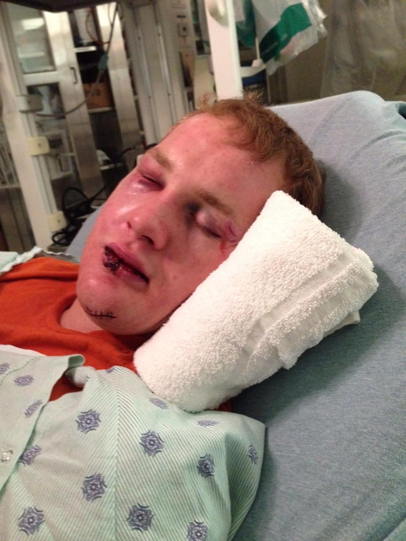 Illustration for article titled MLB Prospect's Lawyer Releases Graphic Photos After Alleged Assault